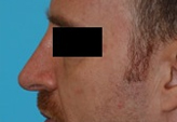 Patient # 88282 After Photo # 2