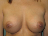 Patient # 47065 After Photo # 2