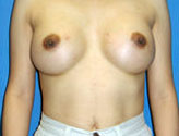 Patient # 33122 After Photo # 2