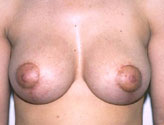 Patient # 59446 After Photo # 2
