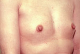 Patient # 62047 Before Photo # 1
