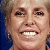 Patient # 34348 After Photo # 2