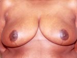 Patient # 67760 After Photo # 2