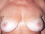 Patient # 44098 After Photo # 2