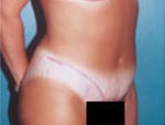 Patient # 75983 After Photo # 2