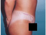 Patient # 75983 After Photo # 4