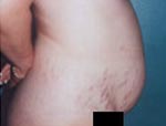 Patient # 75983 Before Photo # 3
