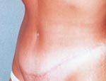 Patient # 33827 After Photo # 2