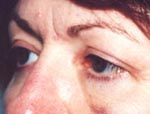Patient # 70575 After Photo # 2