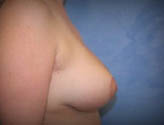 Patient # 14739 After Photo # 6