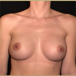 Patient # 24036 After Photo # 2