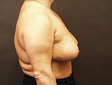 Patient # 98296 After Photo # 4