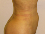 Patient # 24547 After Photo # 4