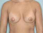 Patient # 13625 After Photo # 2