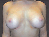 Patient # 38516 After Photo # 2