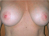 Patient # 16648 After Photo # 2