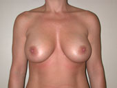 Patient # 59450 After Photo # 2