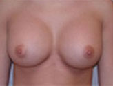 Patient # 97469 After Photo # 2