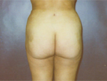 Patient # 55840 After Photo # 2