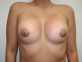 Patient # 80399 After Photo # 2