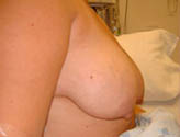 Patient # 69957 Before Photo # 3