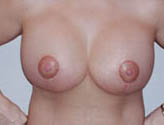 Patient # 47466 After Photo # 2