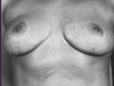 Patient # 96784 After Photo # 2
