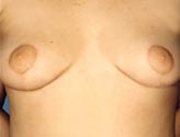 Patient # 48827 After Photo # 2