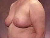 Patient # 15118 After Photo # 2