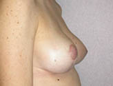 Patient # 16784 After Photo # 6