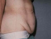 Patient # 43734 Before Photo # 3