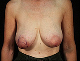 Patient # 15907 Before Photo # 1