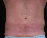 Patient # 49807 After Photo # 2