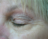 Patient # 82517 After Photo # 6