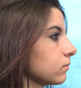 Patient # 51727 After Photo # 2