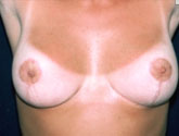 Patient # 23380 After Photo # 2
