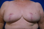 Patient # 48401 After Photo # 2