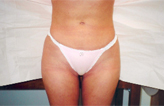 Patient # 79953 After Photo # 2