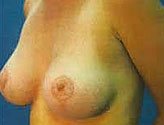 Patient # 48742 After Photo # 2