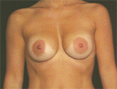 Patient # 59582 After Photo # 2