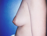 Patient # 10745 Before Photo # 1