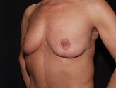 Patient # 68062 After Photo # 6