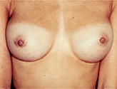 Patient # 41784 After Photo # 2
