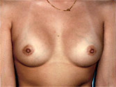 Patient # 18545 After Photo # 2