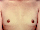 Patient # 18545 Before Photo # 1