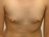 Patient # 12421 Before Photo # 1
