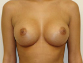 Patient # 25469 After Photo # 2