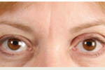 Patient # 43965 After Photo # 2