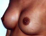 Patient # 23707 After Photo # 2