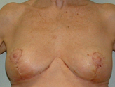 Patient # 22119 After Photo # 2